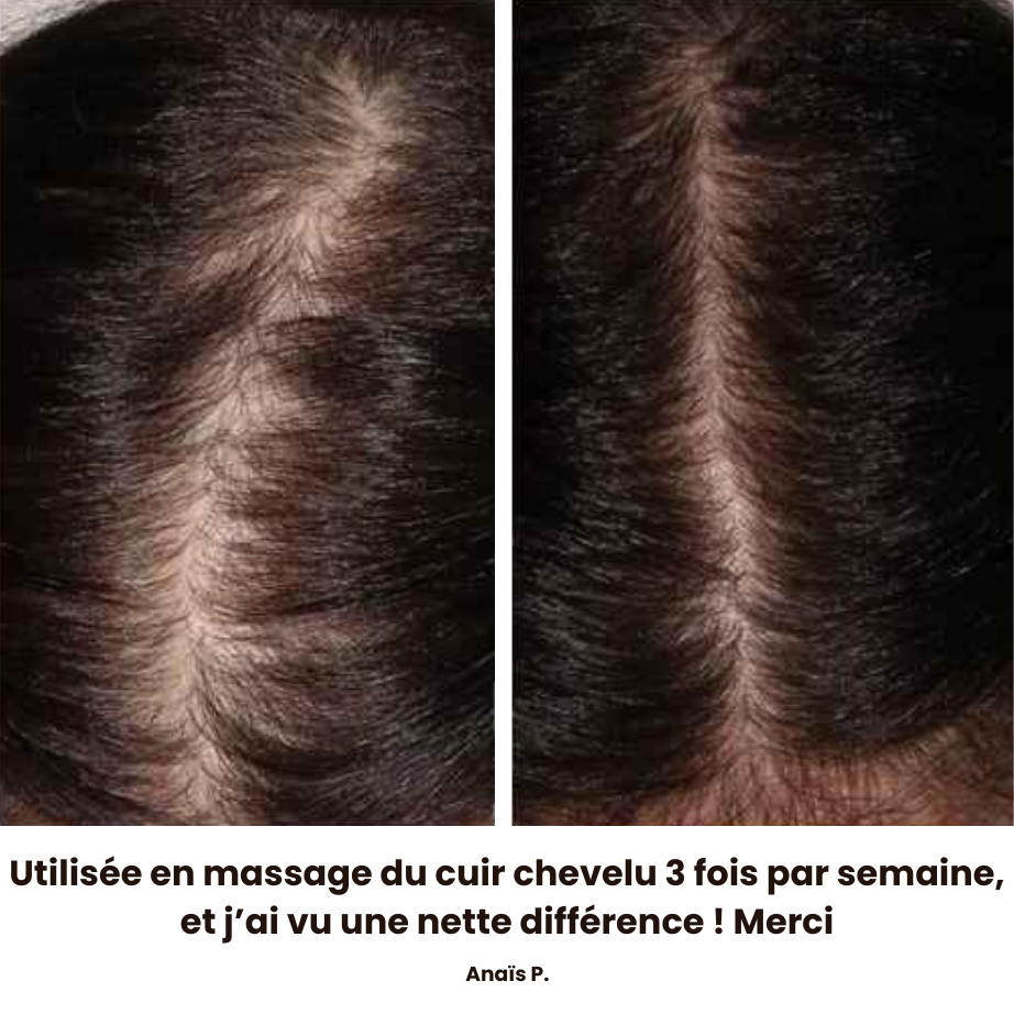CL'HAIR Huile de croissance capillaire
