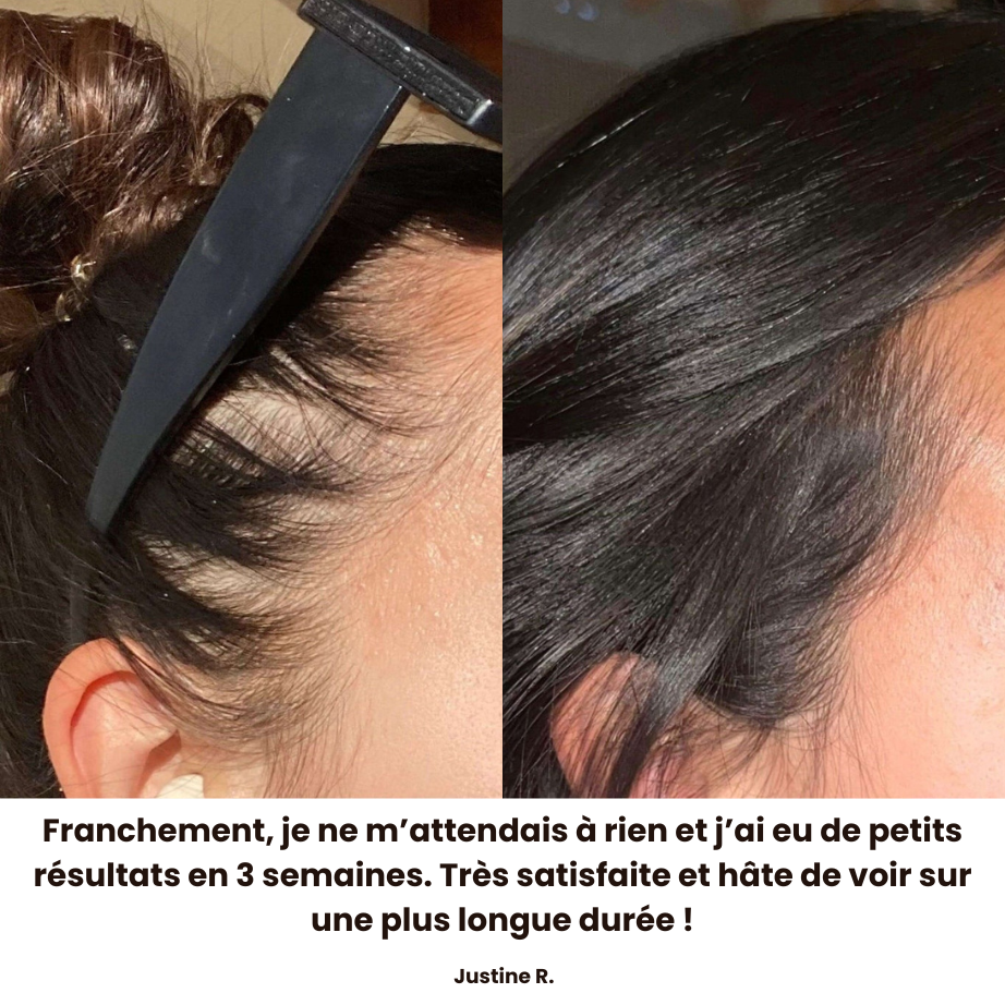 CL'HAIR Huile de croissance capillaire