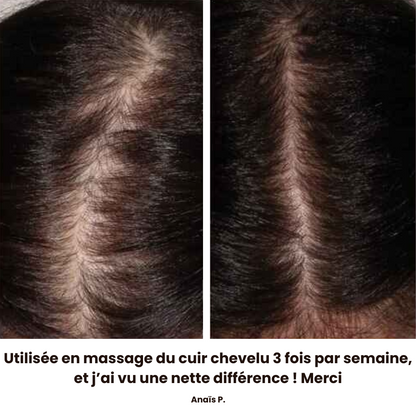 CL'HAIR Huile de croissance capillaire